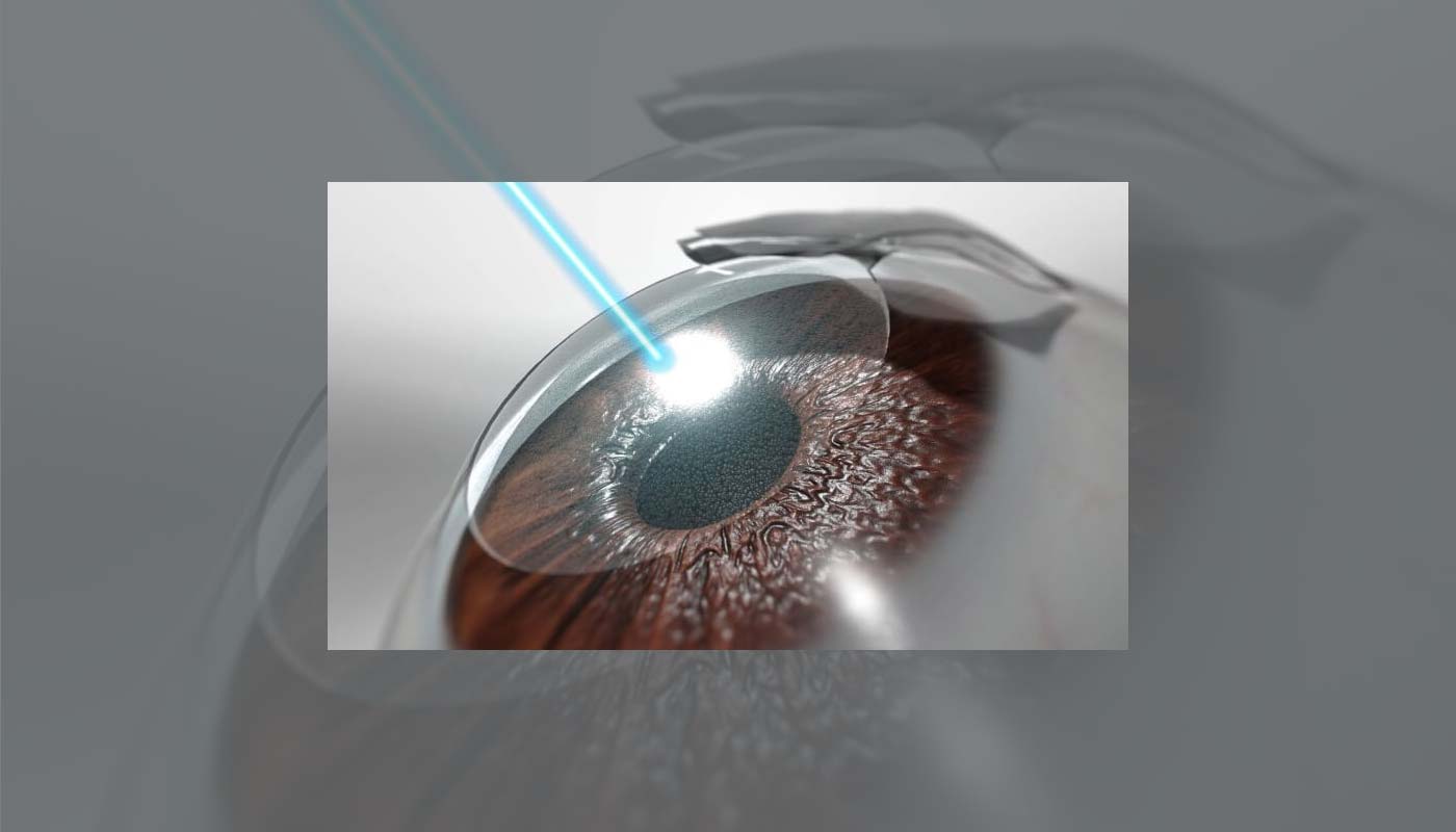 Refractive Surgery: A Clearer Vision Without Glasses or Contacts